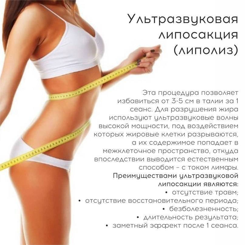 Отличие процедуры ульфит от других методов безоперационной липосакции