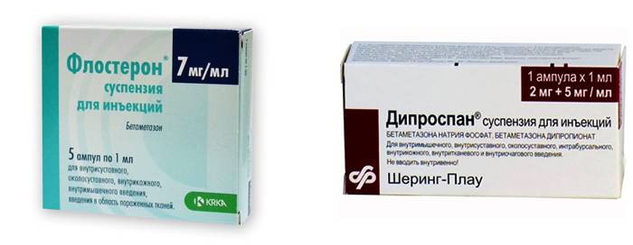 Флостерон или дипроспан: что лучше для блокады?