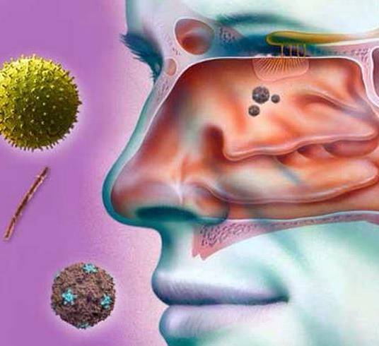 В чем разница между синуситом и ринитом?