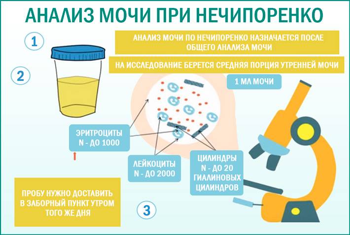 Анализ мочи по нечипоренко: расшифровка, как сдавать, отличие с оам