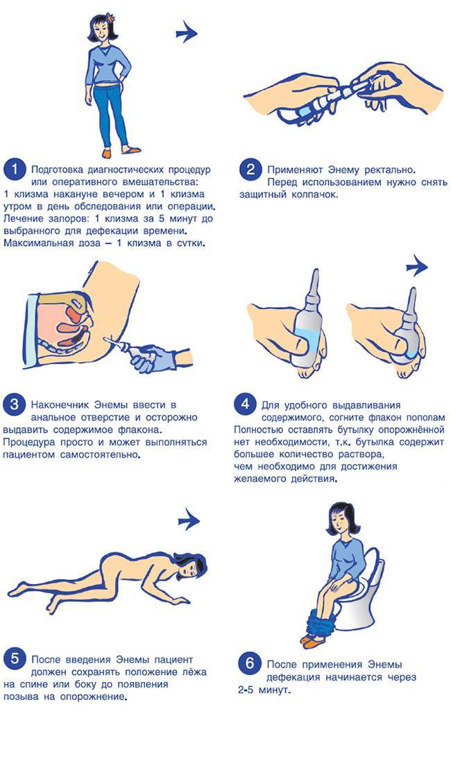 Эзиклен® или фортранс®: что лучше - о здоровье кишечника