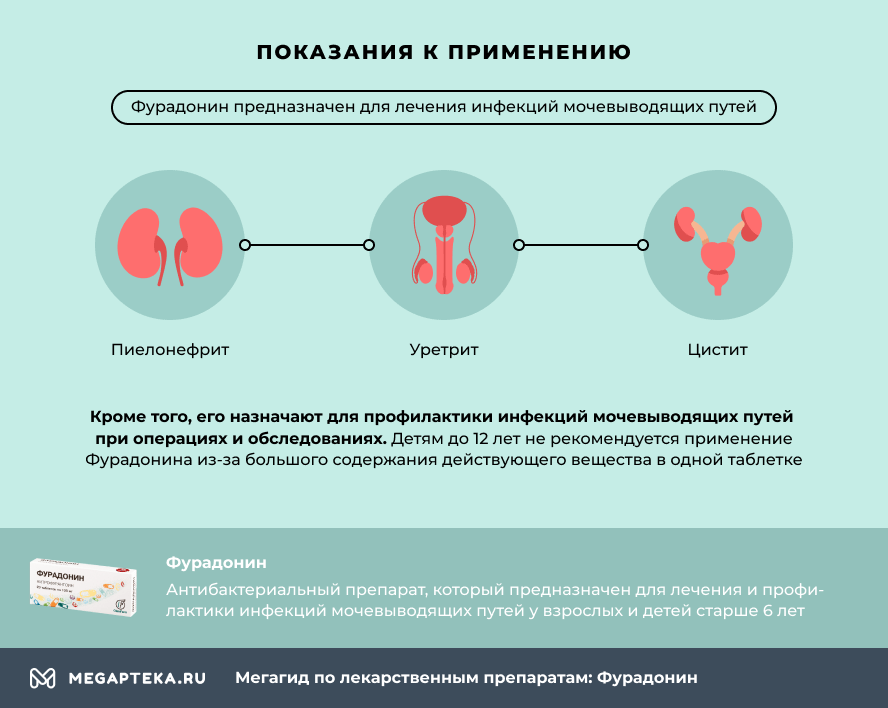 Рекомендуемые женщинам медикаменты при цистите