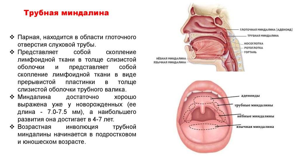 Чем отличаются аденоиды от миндалин, и нужно ли их удалять — министерство здравоохранения республики татарстан гауз "республиканская клиническая инфекционная больница им.проф.а.ф.агафонова"