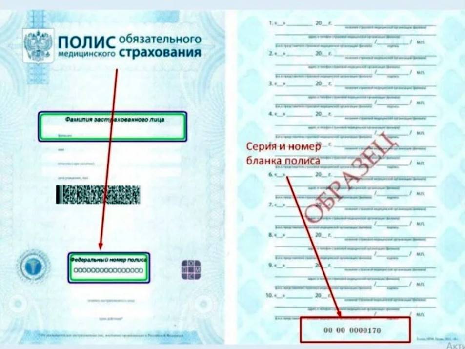 Что такое полис дмс и как его выбрать