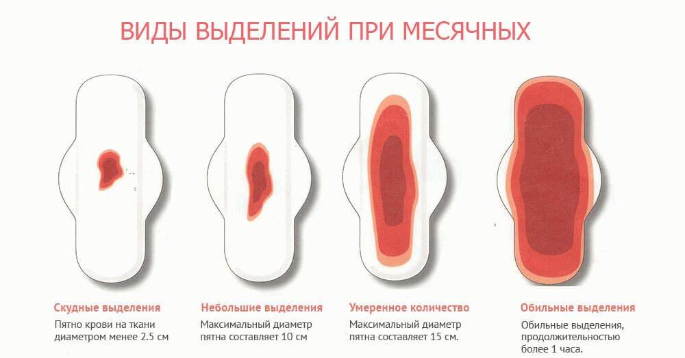Маточное кровотечение