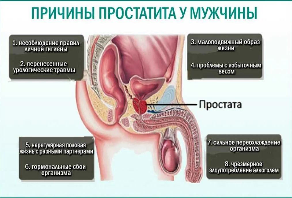 Лечение заболеваний простаты (предстательной железы) - симптомы и причины