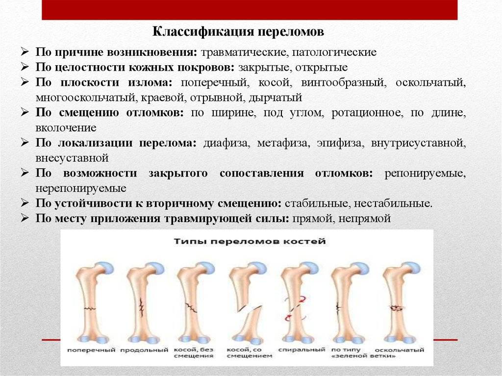 Оказание первой помощи при переломах: правила иммобилизации