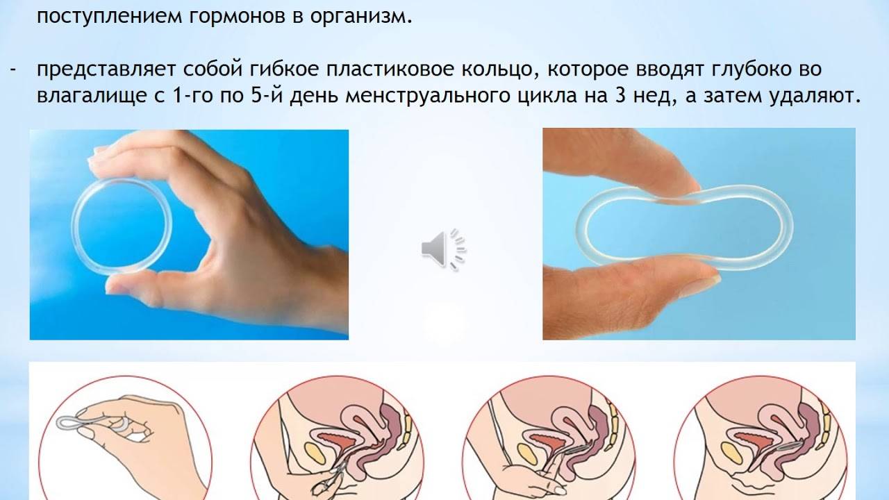 Что лучше Новаринг или Ярина: сравнение и отличия