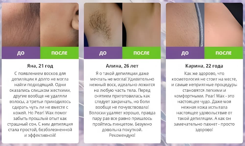 Лазерная эпиляция vs ваксинг или шугаринг: что выбрать? - клиника "отражение"