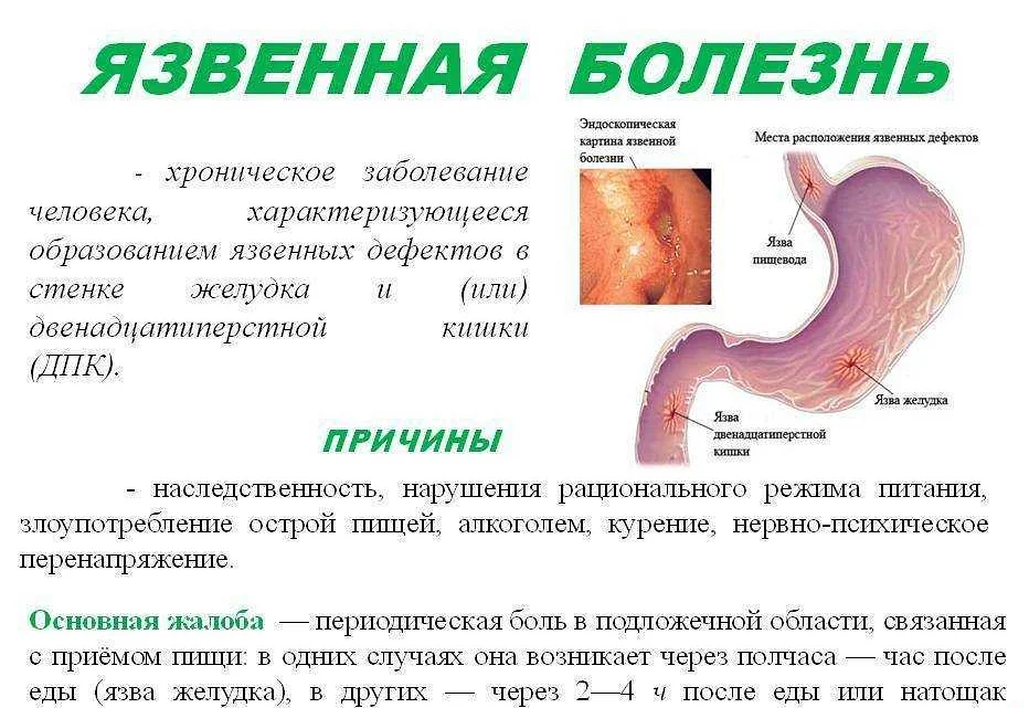 Как отличить гастрит от язвы желудка и что хуже