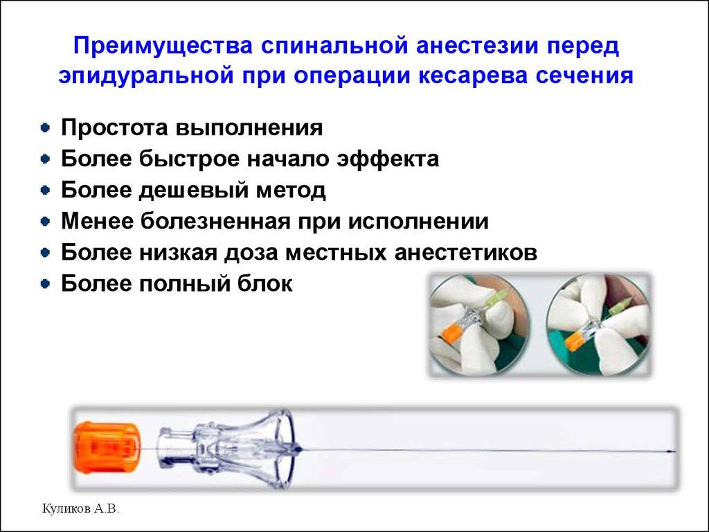 В чем разница между эпидуральной и спинальной анестезией, какая безопаснее и что лучше выбрать?
