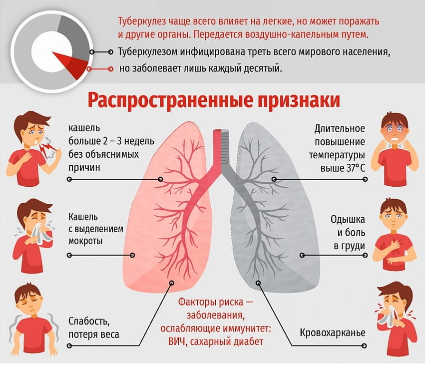 Чем отличается пневмония от туберкулеза: особенности болезней