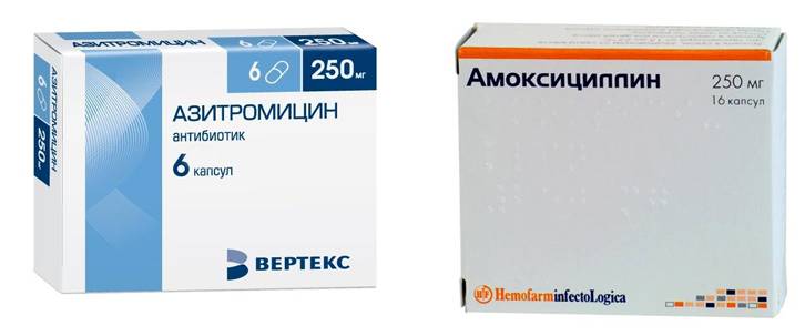 Амоксициллин или азитромицин - что лучше и в чем разница