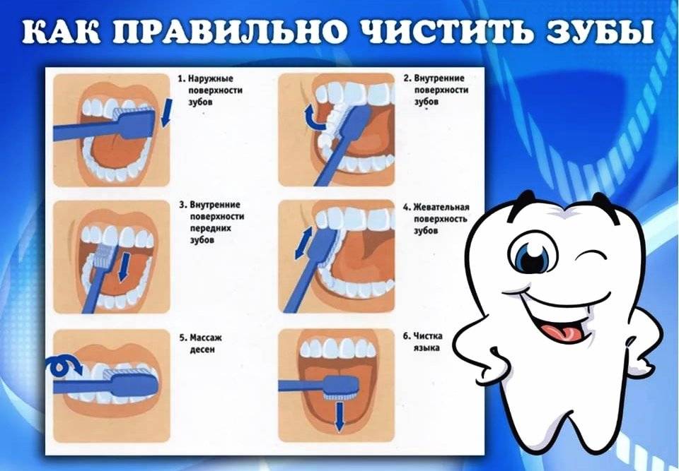 Как выбрать электрическую зубную щетку, какие виды бывают?