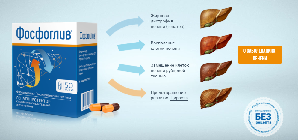 Какой из препаратов лучше: фосфоглив или эссенциале?