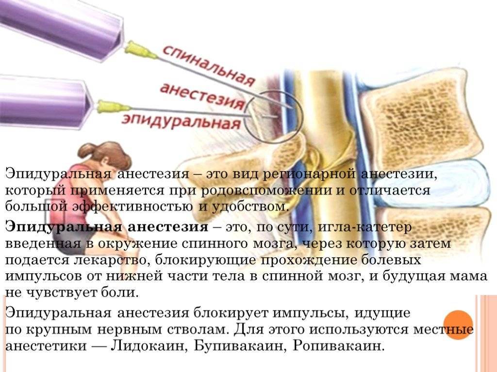 Спинальная и эпидуральная анестезия: каковы отличия? – медицинский портал