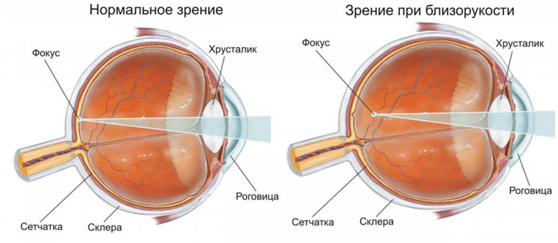 3.4. глаз как оптический инструмент