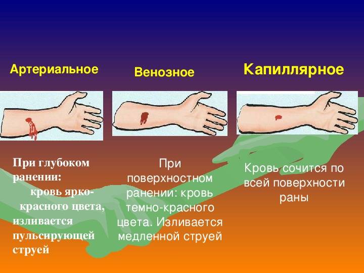 Артерии и вены: каковы различия между ними?