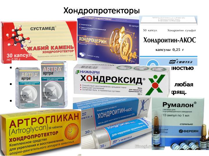 Дона или терафлекс: что лучше и в чем разница (отличие составов, отзывы врачей)
дона или терафлекс: что лучше и в чем разница (отличие составов, отзывы врачей)