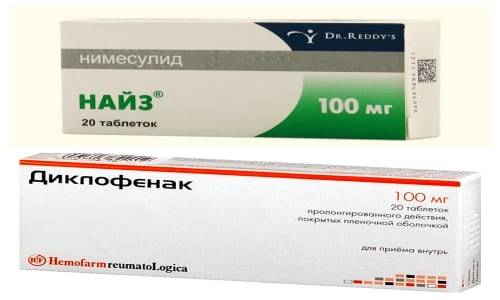 Лечение при остеохондрозе: вольтарен, диклофенак, найз – все про остеохондроз