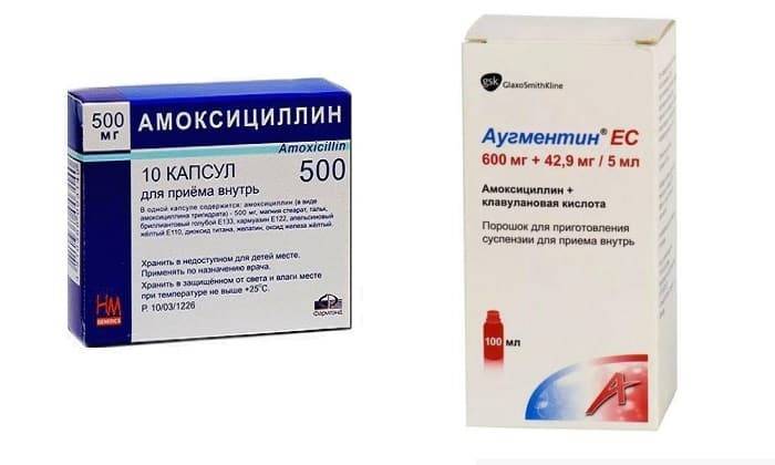 Амоксиклав или аугментин что дешевле | болезнь паркинсона