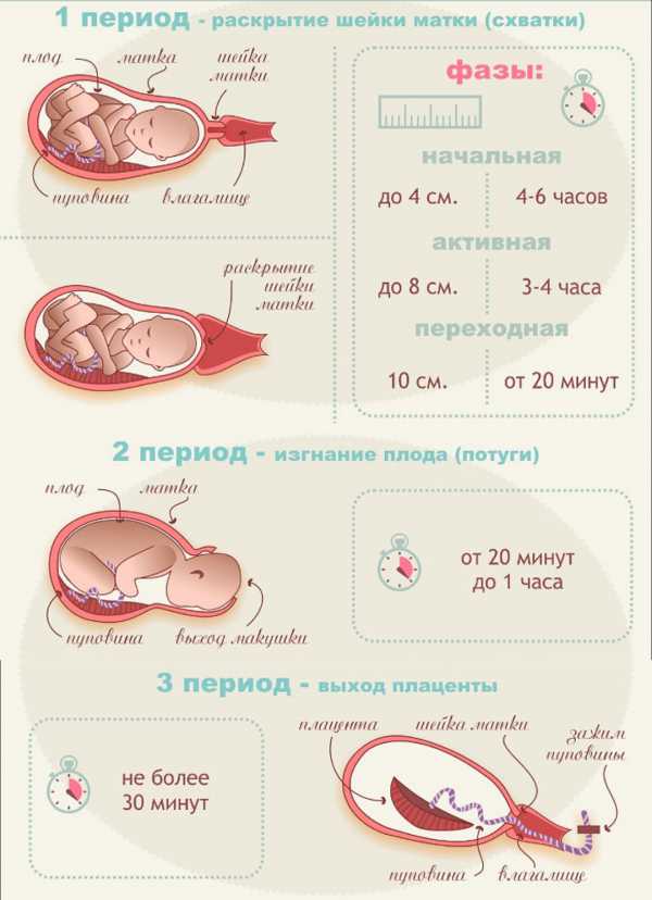 Могут ли ложные схватки перейти в настоящие. отслеживаем родовые схватки. как начинаются настоящие схватки при беременности