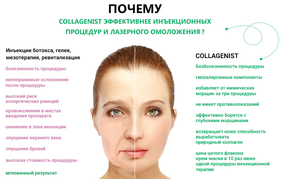 Какая процедура лучше мезотерапия или ботокс