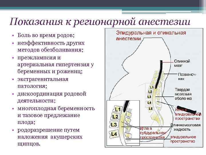 Какой наркоз лучше и эффективнее спинальный или общий