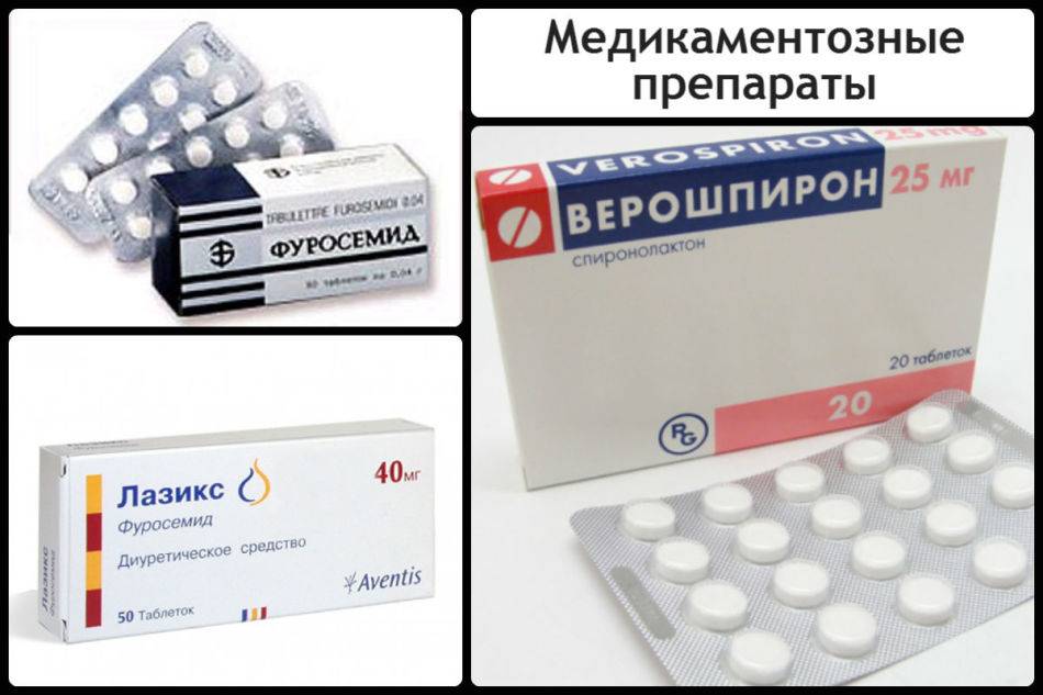 Верошпирон мочегонное или нет: побочные эффекты