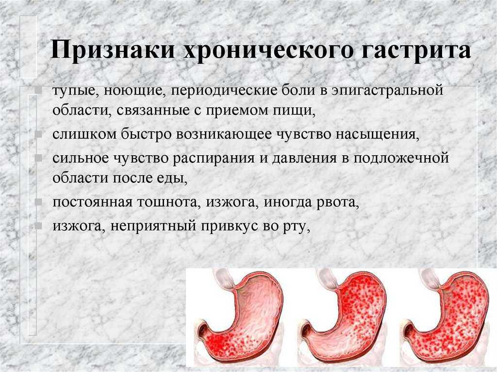 Боли в желудке