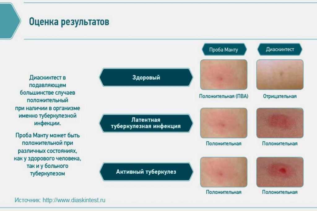 Драстоп или алфлутоп: отличия, применение и эффективность