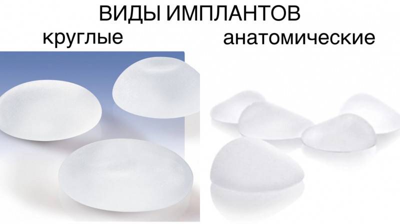 Виды грудных имплантов