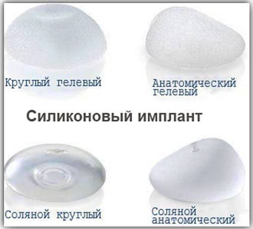 Виды грудных имплантов: размеры и формы, какие лучше (анатомические, силиконовые, гидрогелевые)