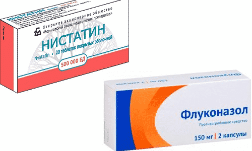 Что лучше нистатин или флуконазол против молочницы