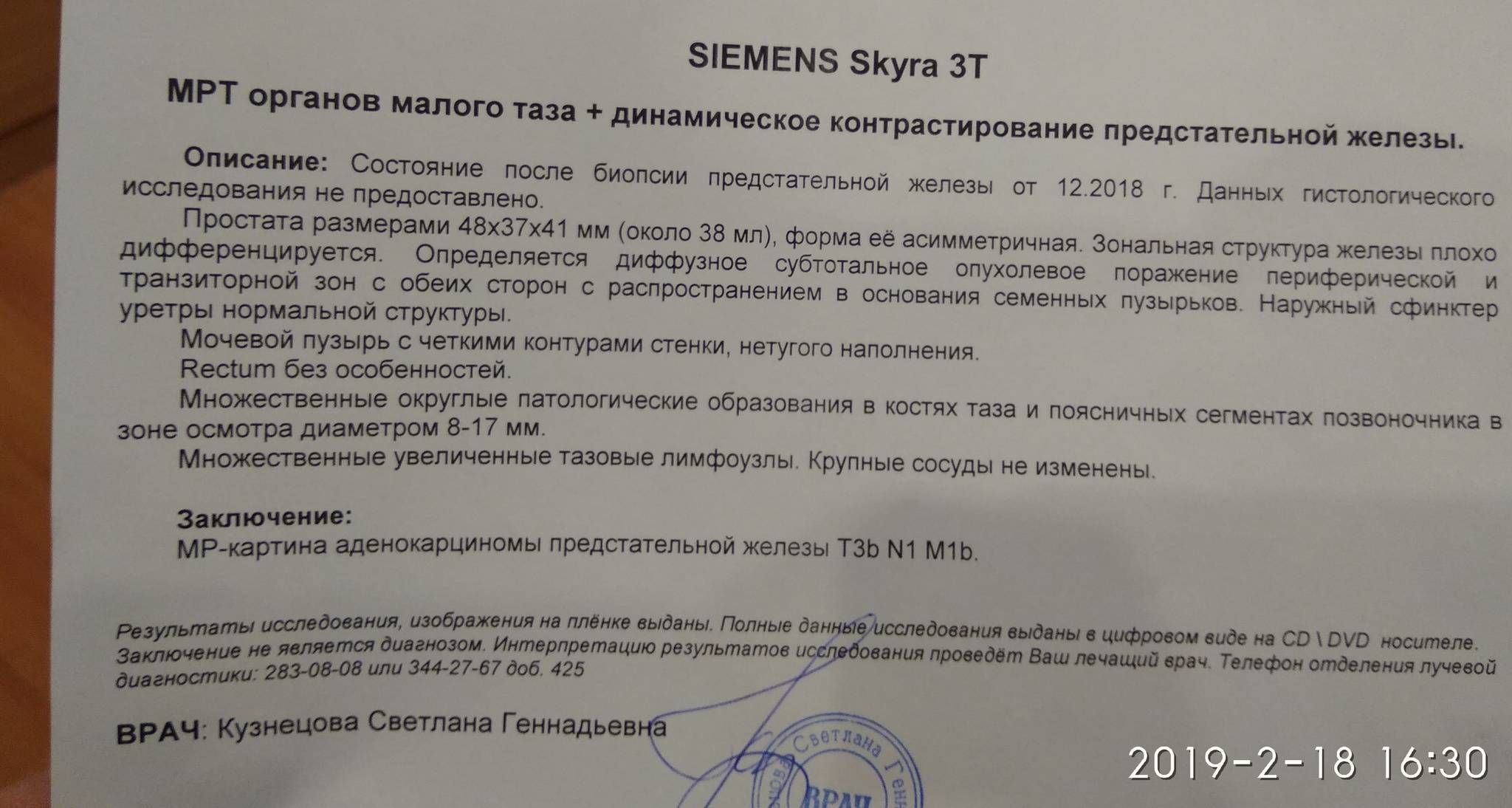 Виды биопсии молочной железы и расшифровка результатов