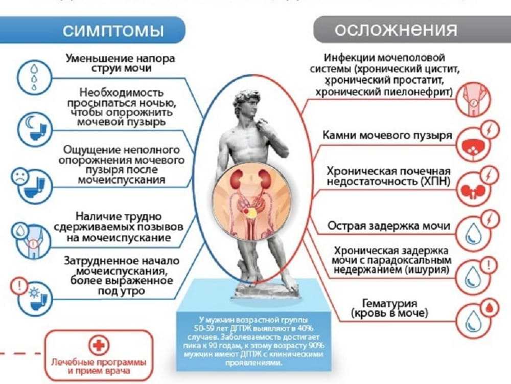 Об аденоме простаты подробно - симптомы, современное лечение