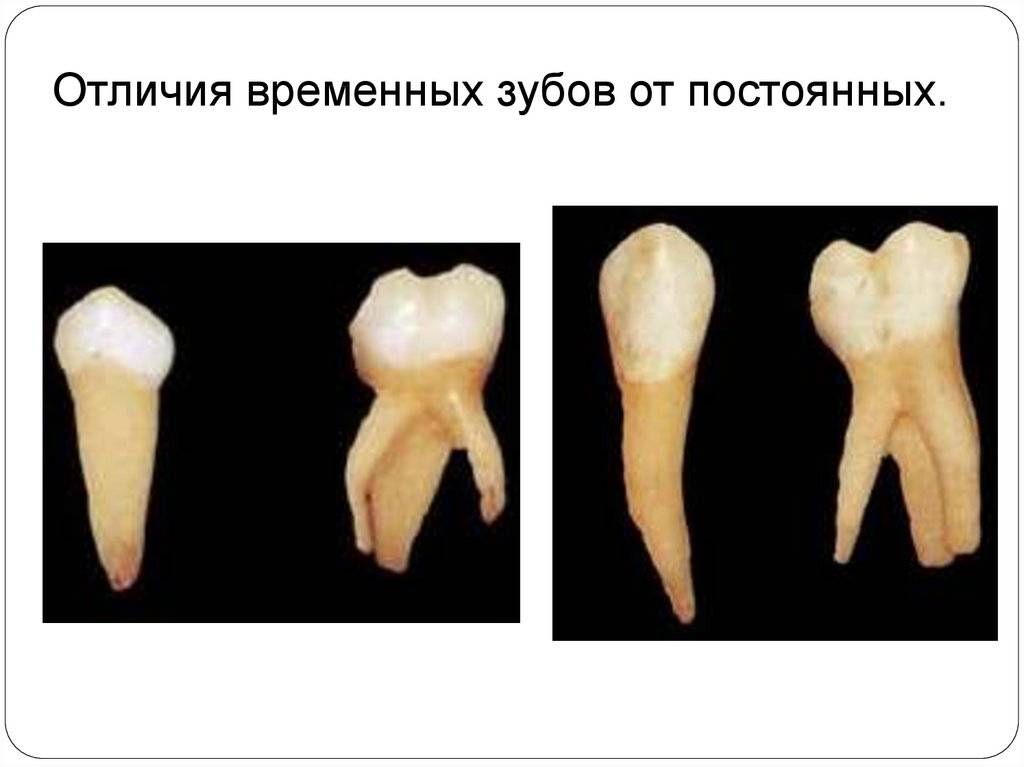 Моляры и премоляры - отличие и особенности, расположение в зубном ряду