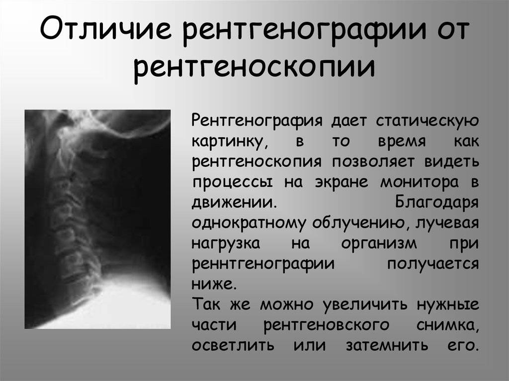 Чем отличается флюорография от рентгенографии легких