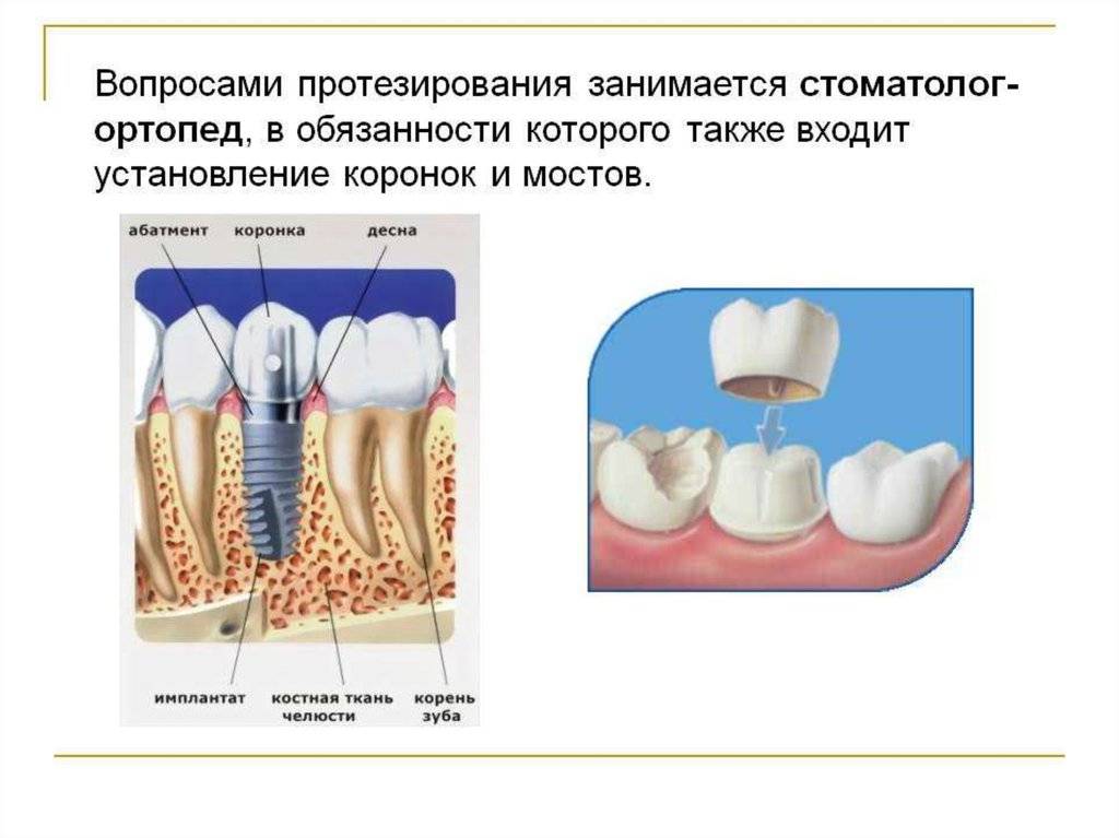 Ортопед или ортодонт: что выбрать? сравнение специальностей