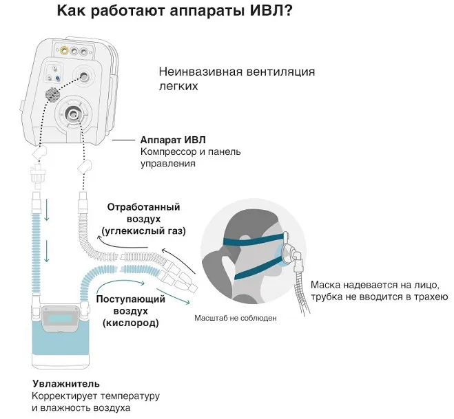Искусственная вентиляция легких - описание услуги, при каких болезнях и какие врачи назначают