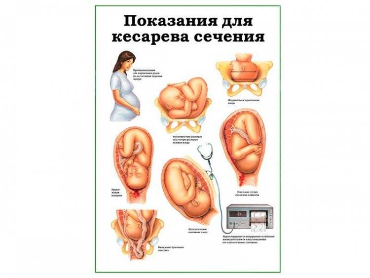 Мама, роди меня бесплатно.  почему роды по омс в россии такие разные и на что точно может рассчитывать женщина