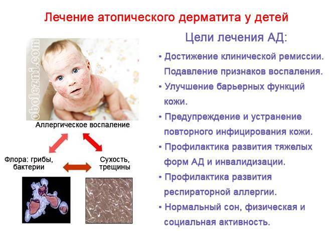 Аллергический дерматит: виды, симптомы, лечение