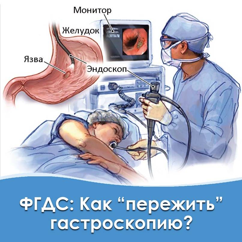 Что такое гастроскопия: подготовка, обезболивание, ход процедуры * клиника диана в санкт-петербурге
