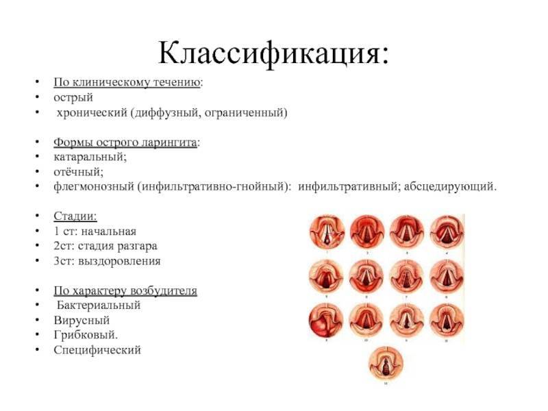 Чем отличается фарингит от ларингита: особенности развития болезней и методы лечения