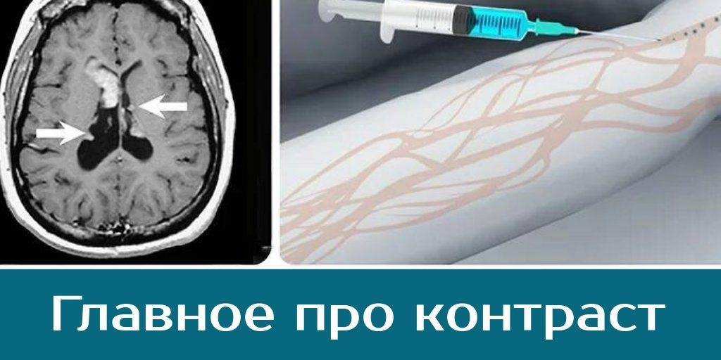 Отличия мрт, мрт с контрастом и мр-ангиографии