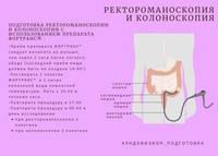 Ректороманоскопия кишечника