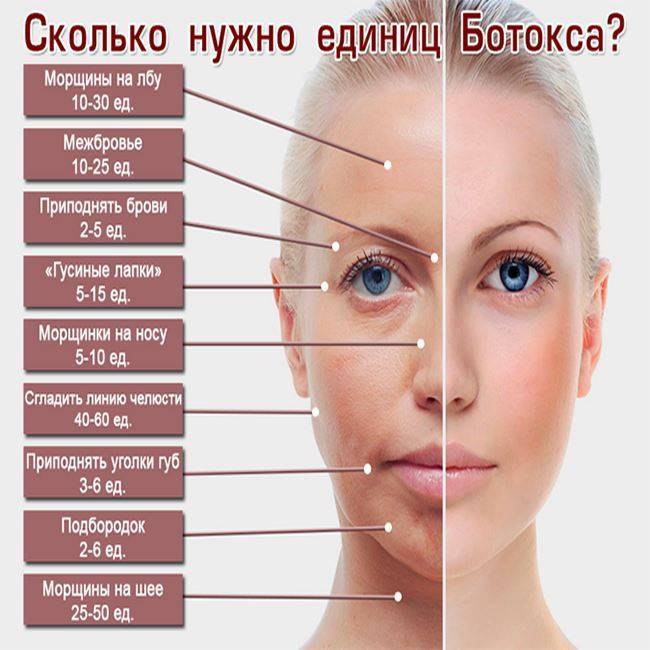 Ботокс или ксеомин: что лучше, чем отличаются, что дольше держится