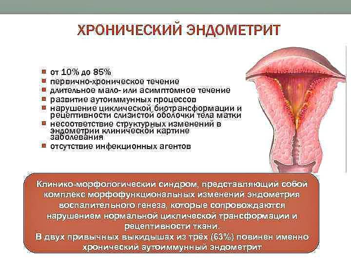 Эндометрит и эндометриоз: различия симптомов и методы лечения