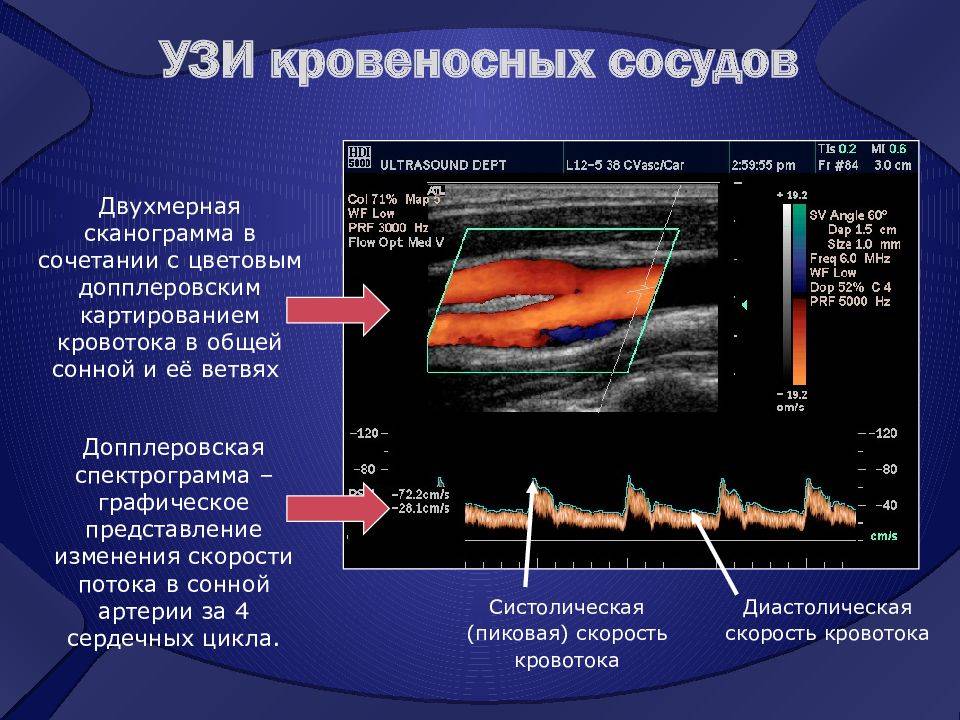 Ультразвуковая диагностика (узи) сосудов: как и когда делают, преимущества, частные ситуации
