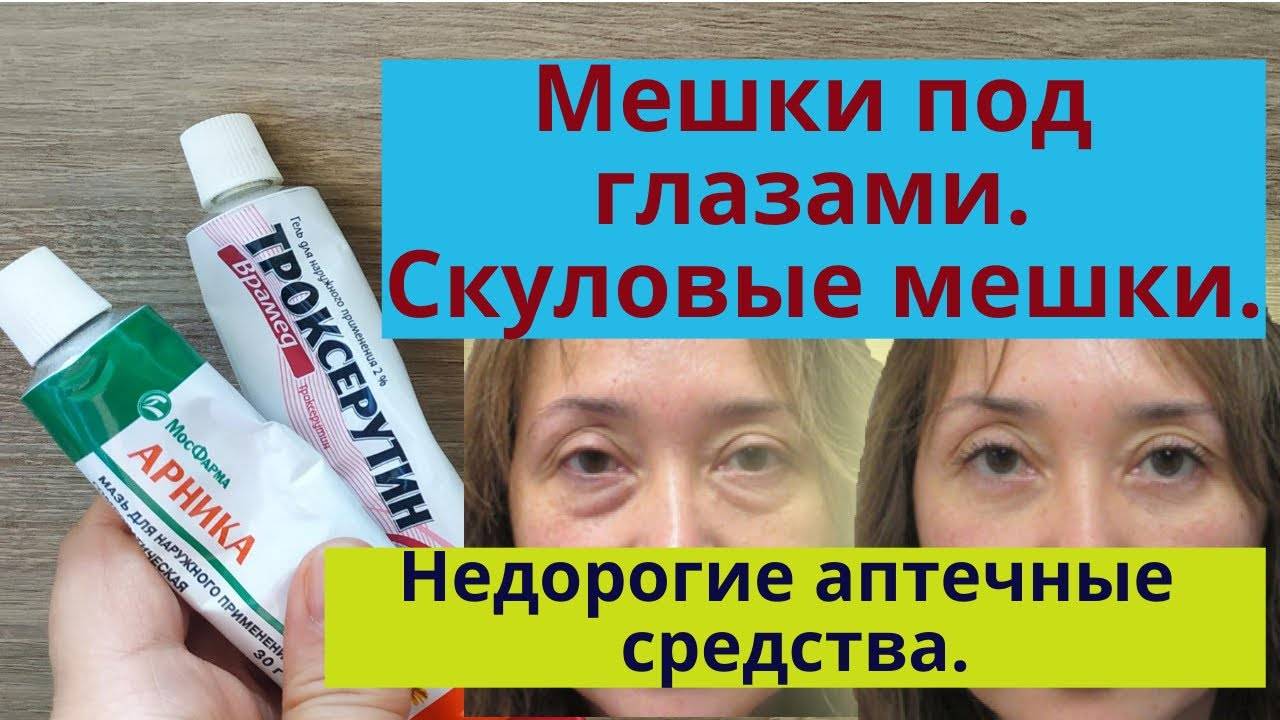 Что лучше лиотон или гепариновая мазь: сравниваем и делаем выбор | в чем разница